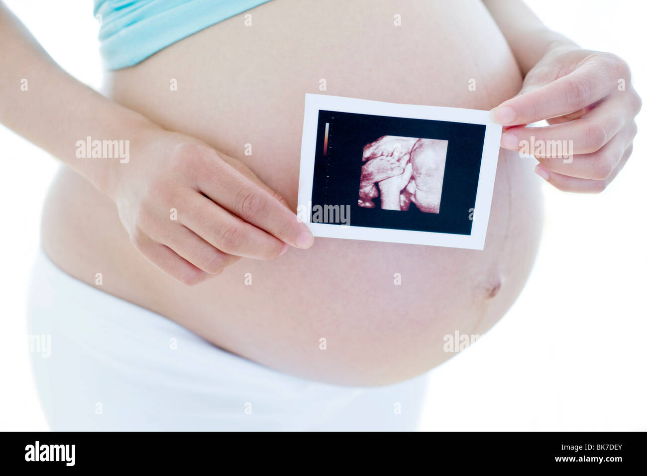 Ultrasound photographs hi-res stock photography and images - Alamy
