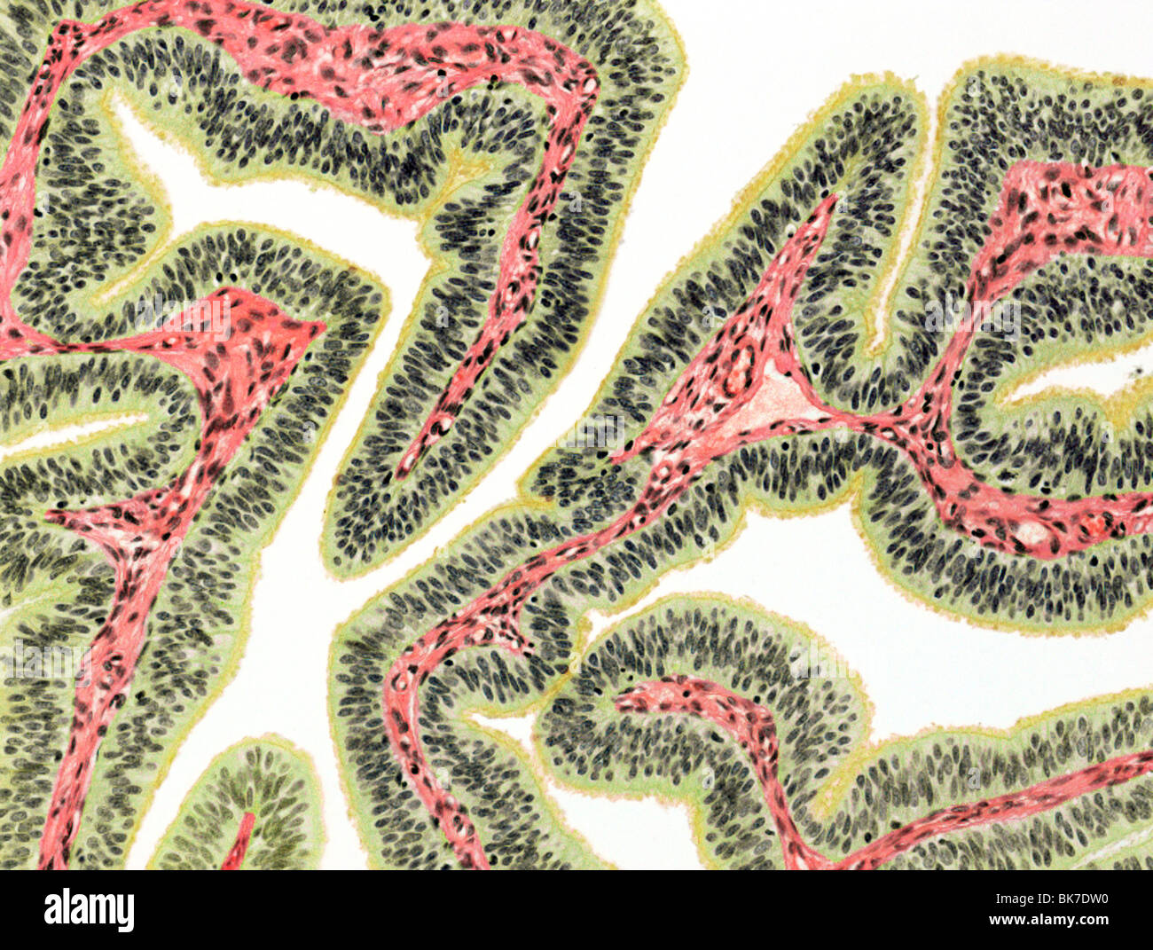 Fallopian tube, light micrograph Stock Photo - Alamy
