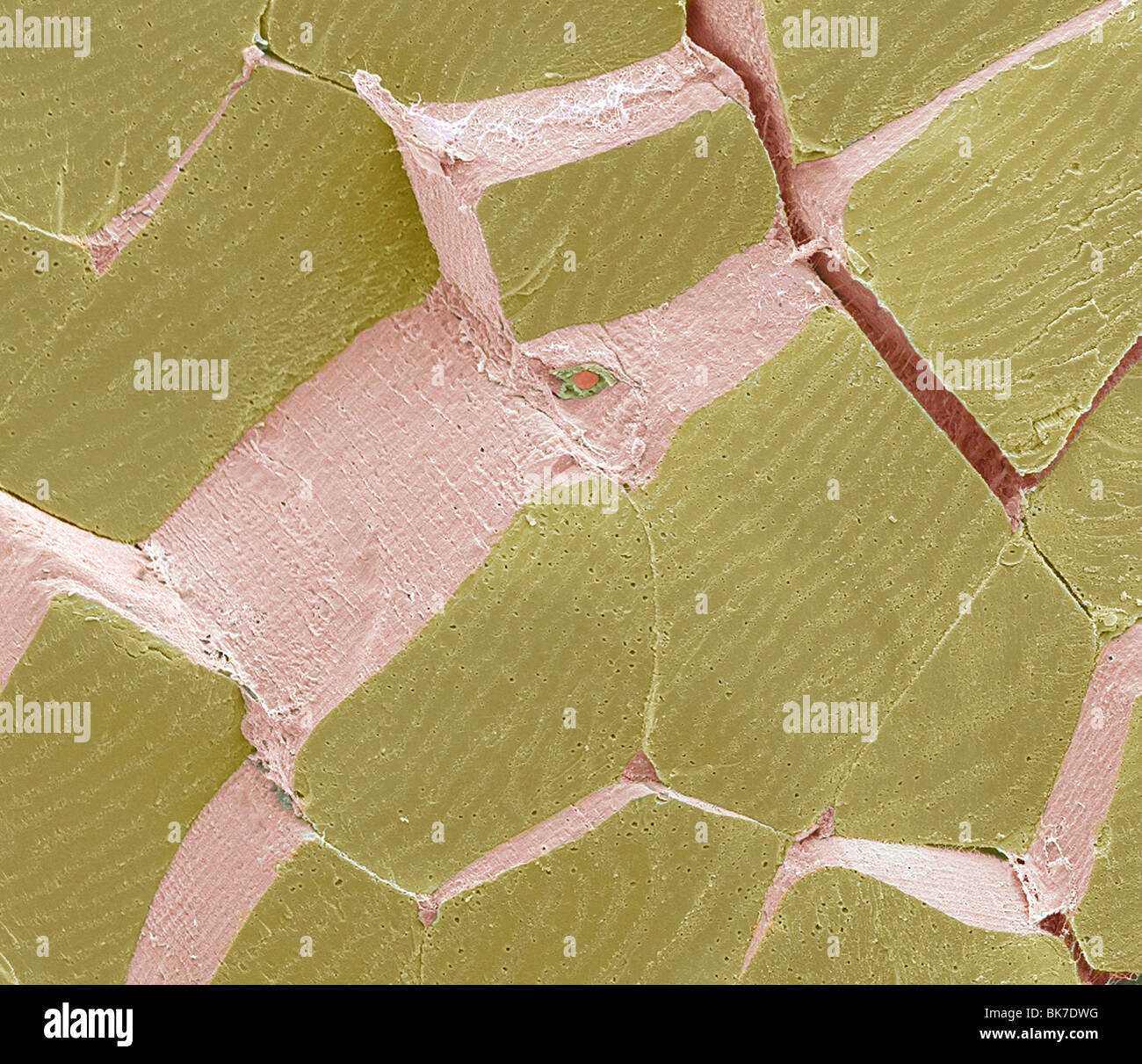 Skeletal muscle fibres, SEM Stock Photo