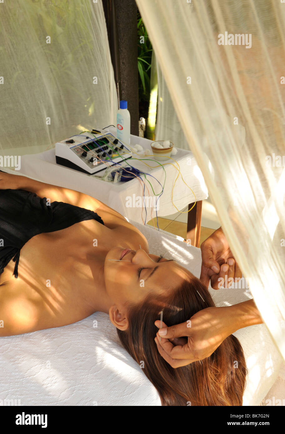 Acupuncture, Nurture Spa, Tagaytay, Philippines, Southeast Asia, Asia Stock Photo
