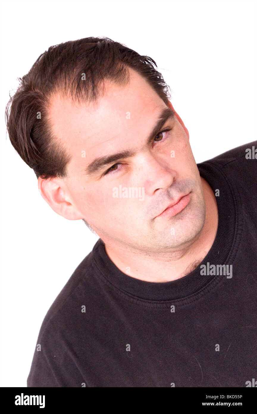 A Serious Looking Man With Receding Hair Line Is Looking Directly