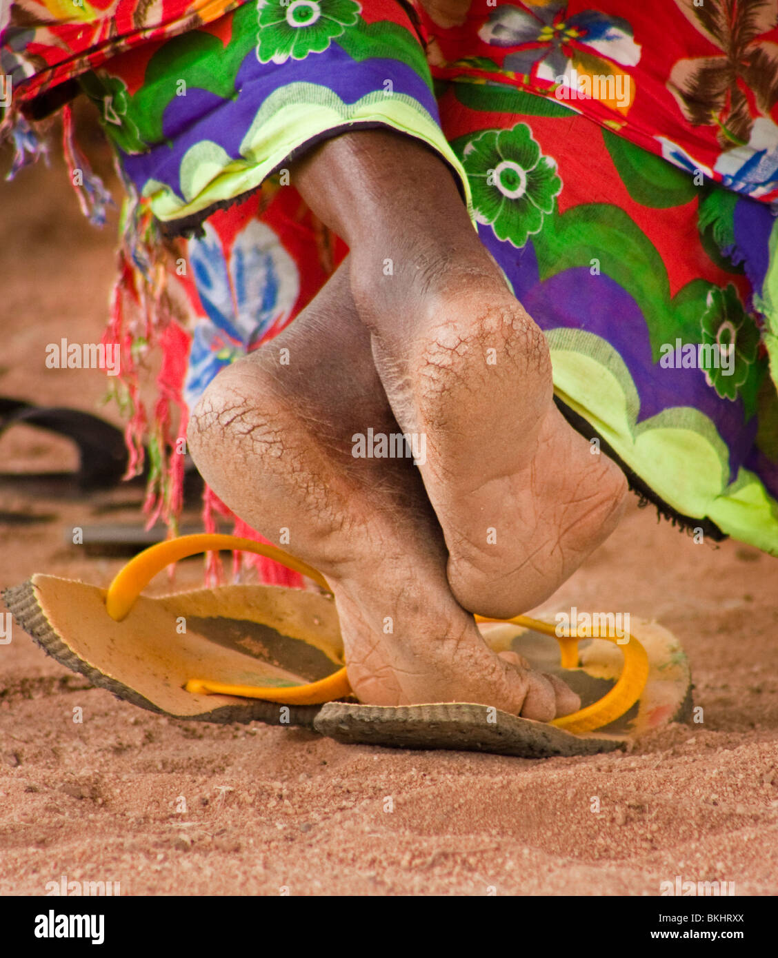 rough feet of an african woman Stock 