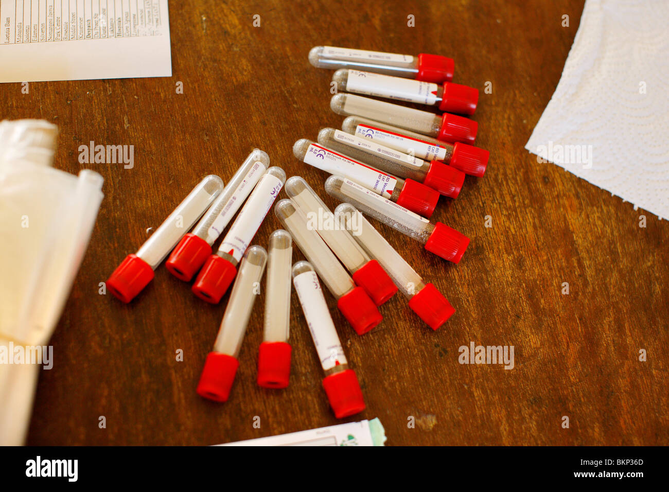 Blood vials for HIV testing Stock Photo Alamy
