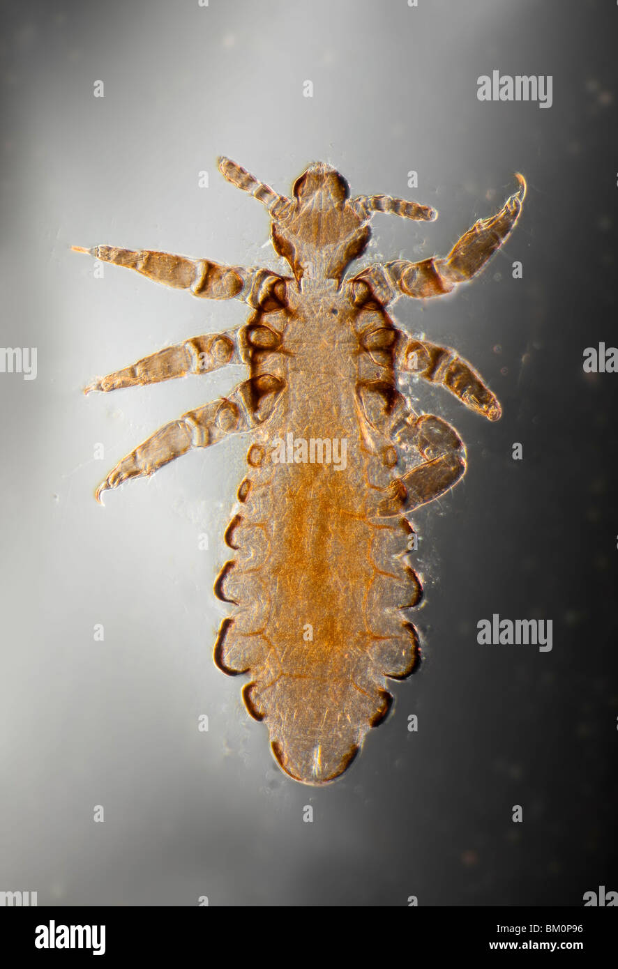 Human head louse, Pediculus humanus capitis, photomicrograph Stock Photo