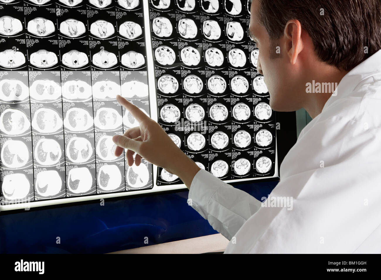 Doctor examining MRI report Stock Photo
