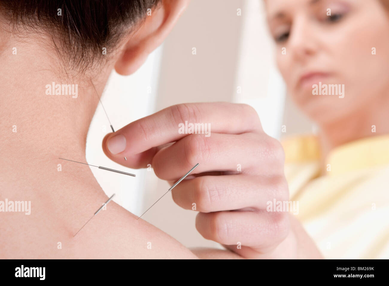 Acupuncturist applying needles on a person's back Stock Photo Alamy