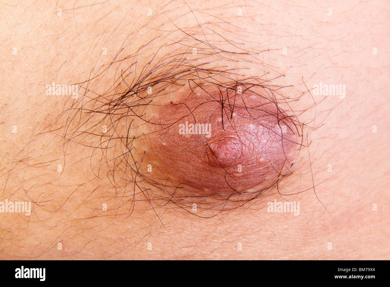 women hairy nipples 