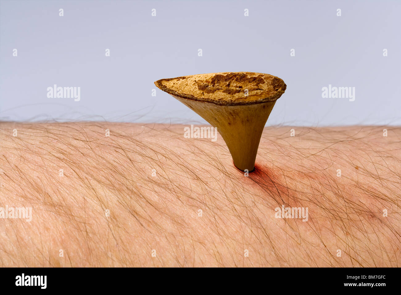 Thorn in the flesh Stock Photo Alamy