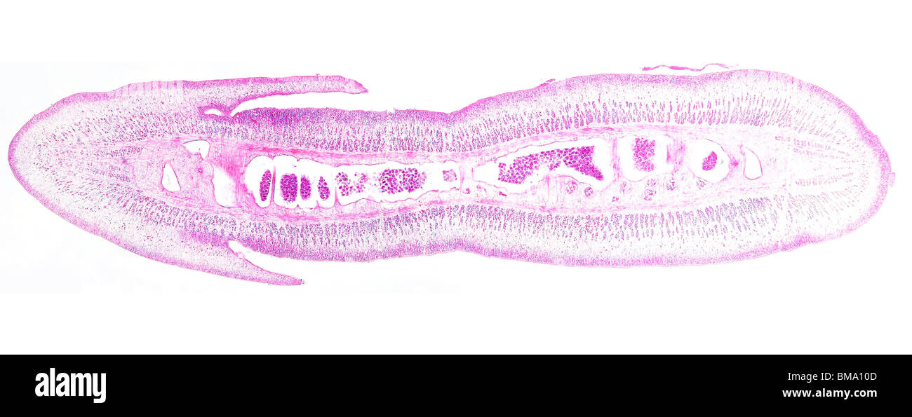 Tapeworm, Taenia, transverse section Stock Photo Alamy