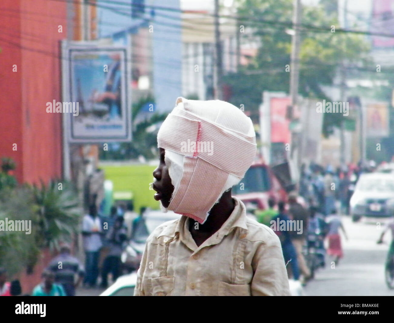 A survivor of the Haiti earthquake seeks treatment in Port au Prince Stock Photo
