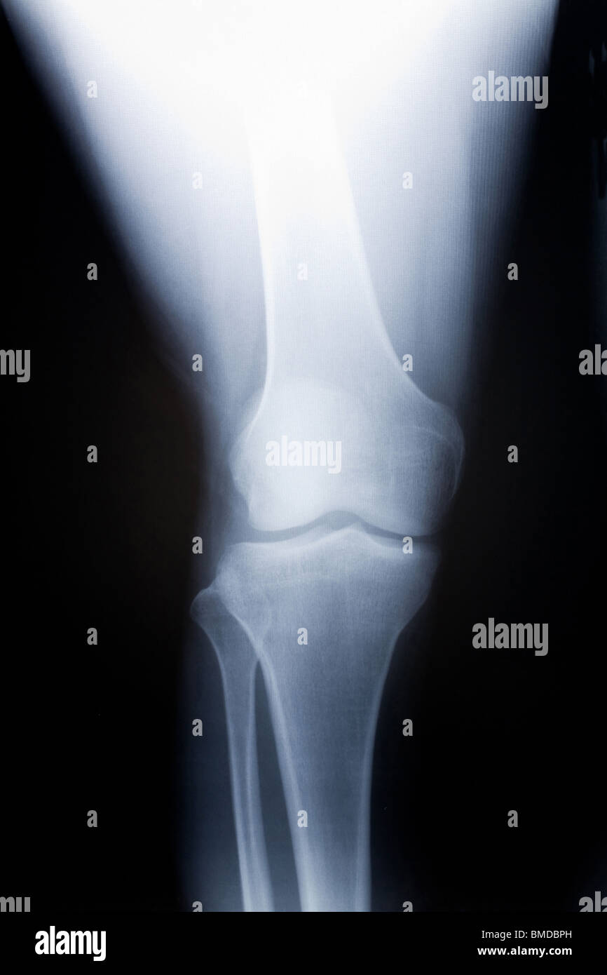 Human knee hi-res stock photography and images - Alamy