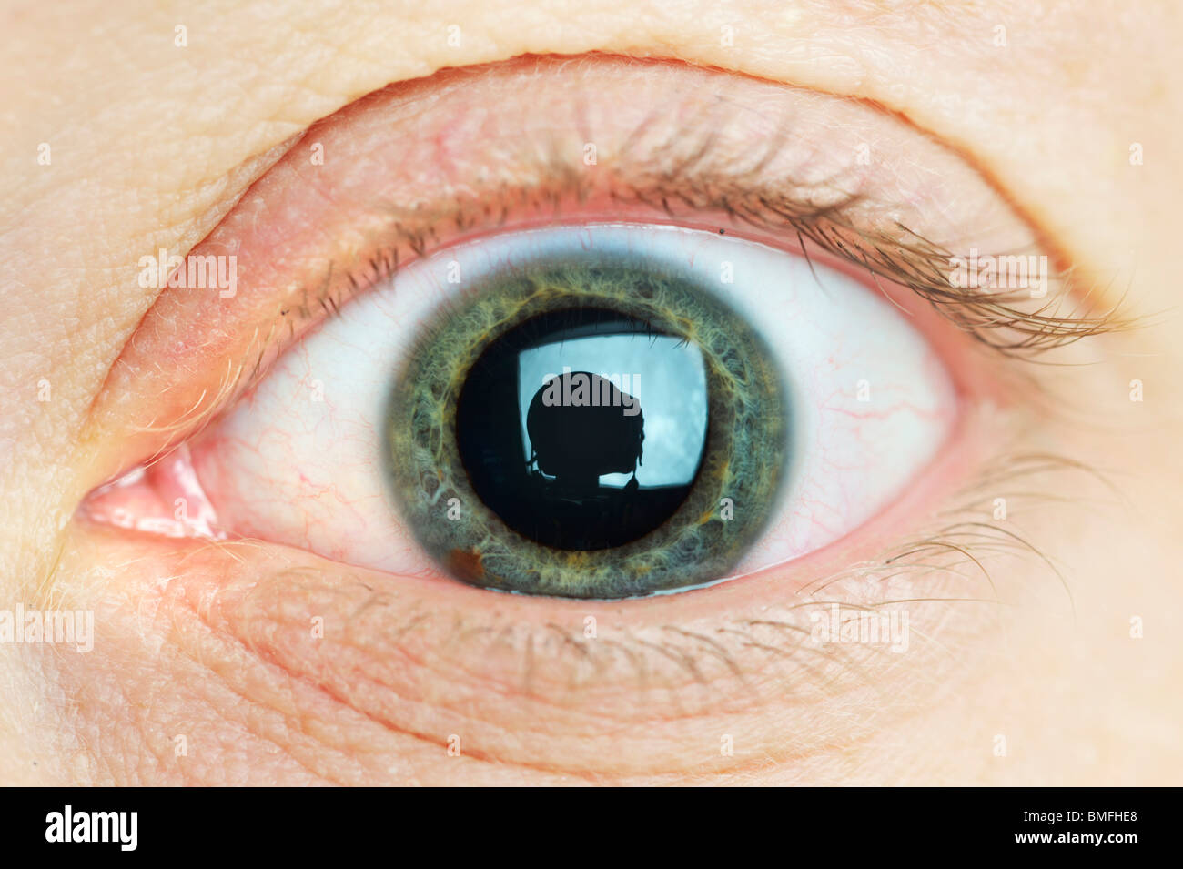 Pupil Eye Dilated Hi Res Stock Photography And Images Alamy