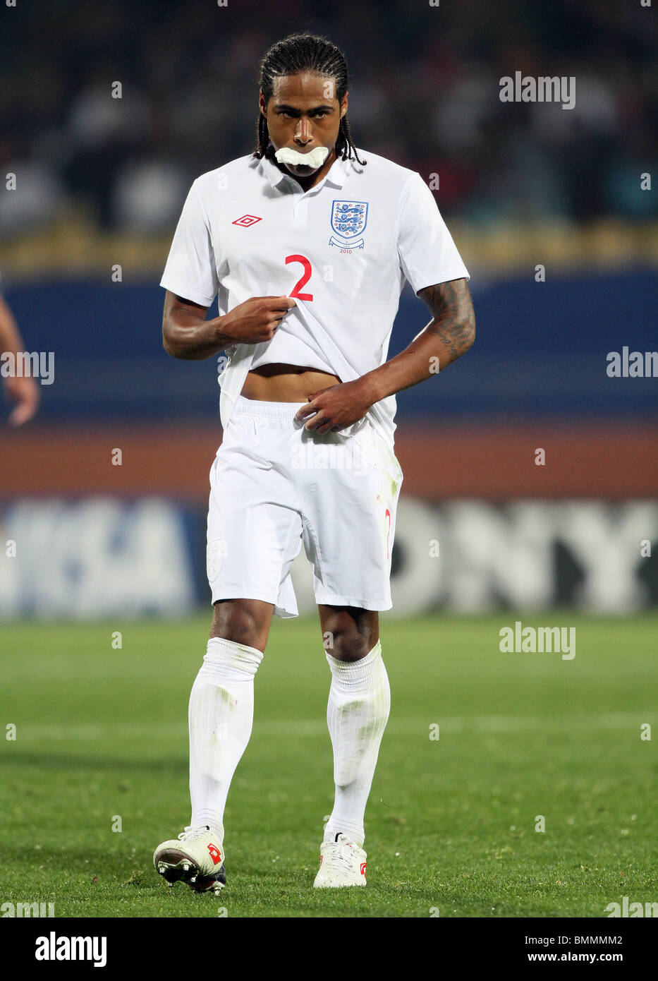 GLEN JOHNSON WITH SPLIT LIP ENGLAND V USA ROYAL BAFOKENG STADIUM ...