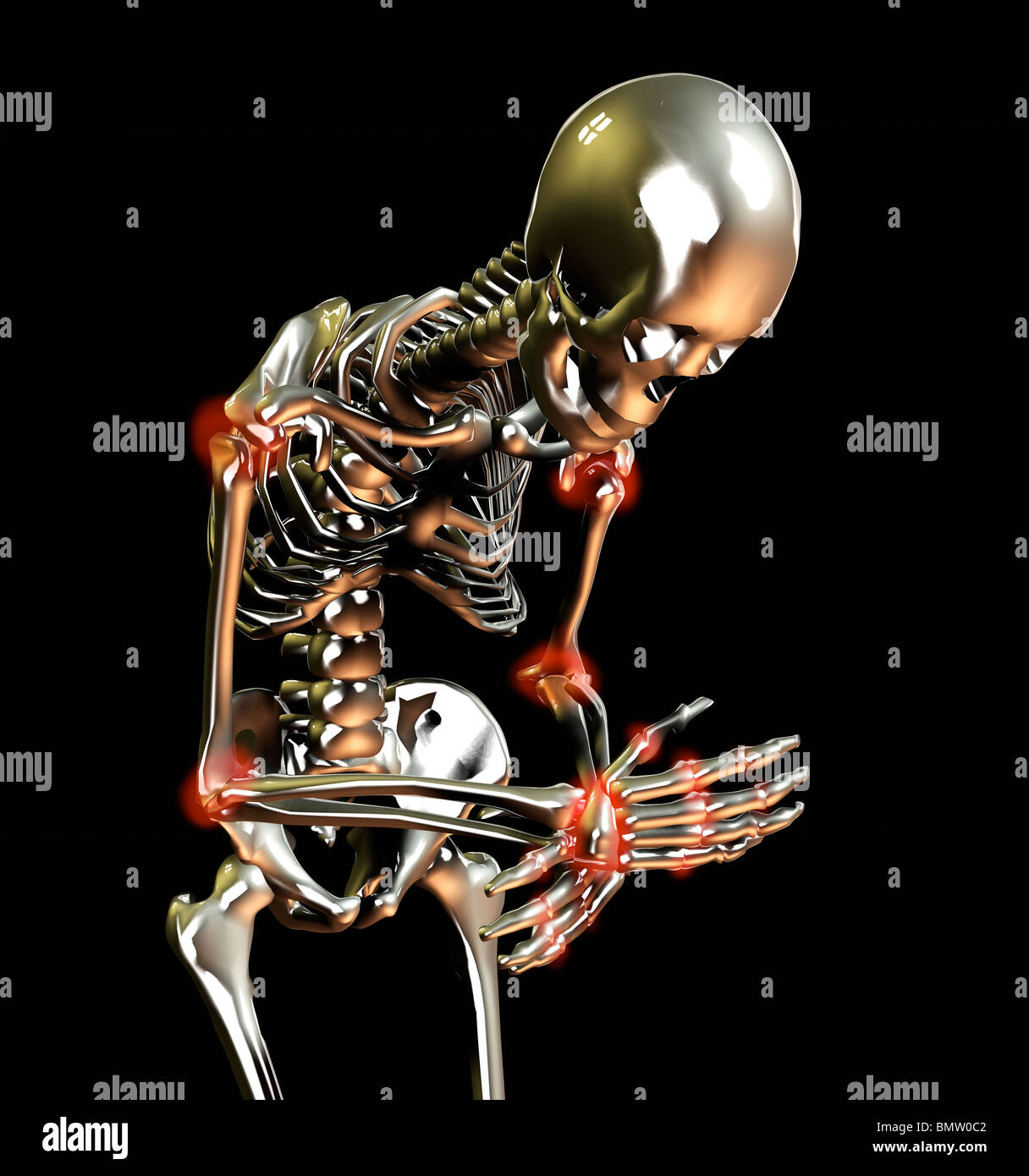 Skeleton Illustrating Joint Pain Stock Photo