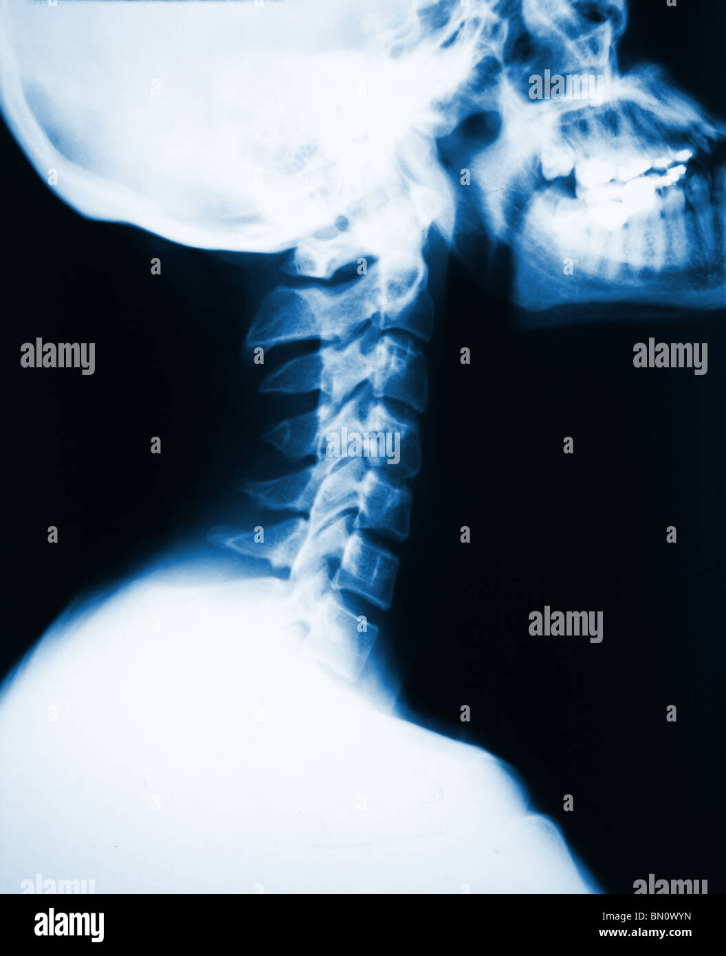 detail of neck xray image Stock Photo Alamy