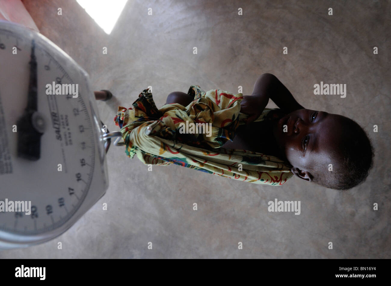 A malnourished child is weighed at an ambulatory medical center in Malawi Africa Stock Photo