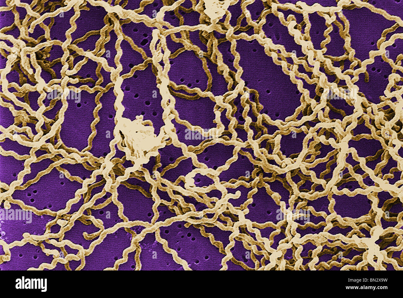 Scanning electron micrograph (SEM) showing a number of Leptospira sp. bacteria atop a 0.1. µm polycarbonate filter. Stock Photo