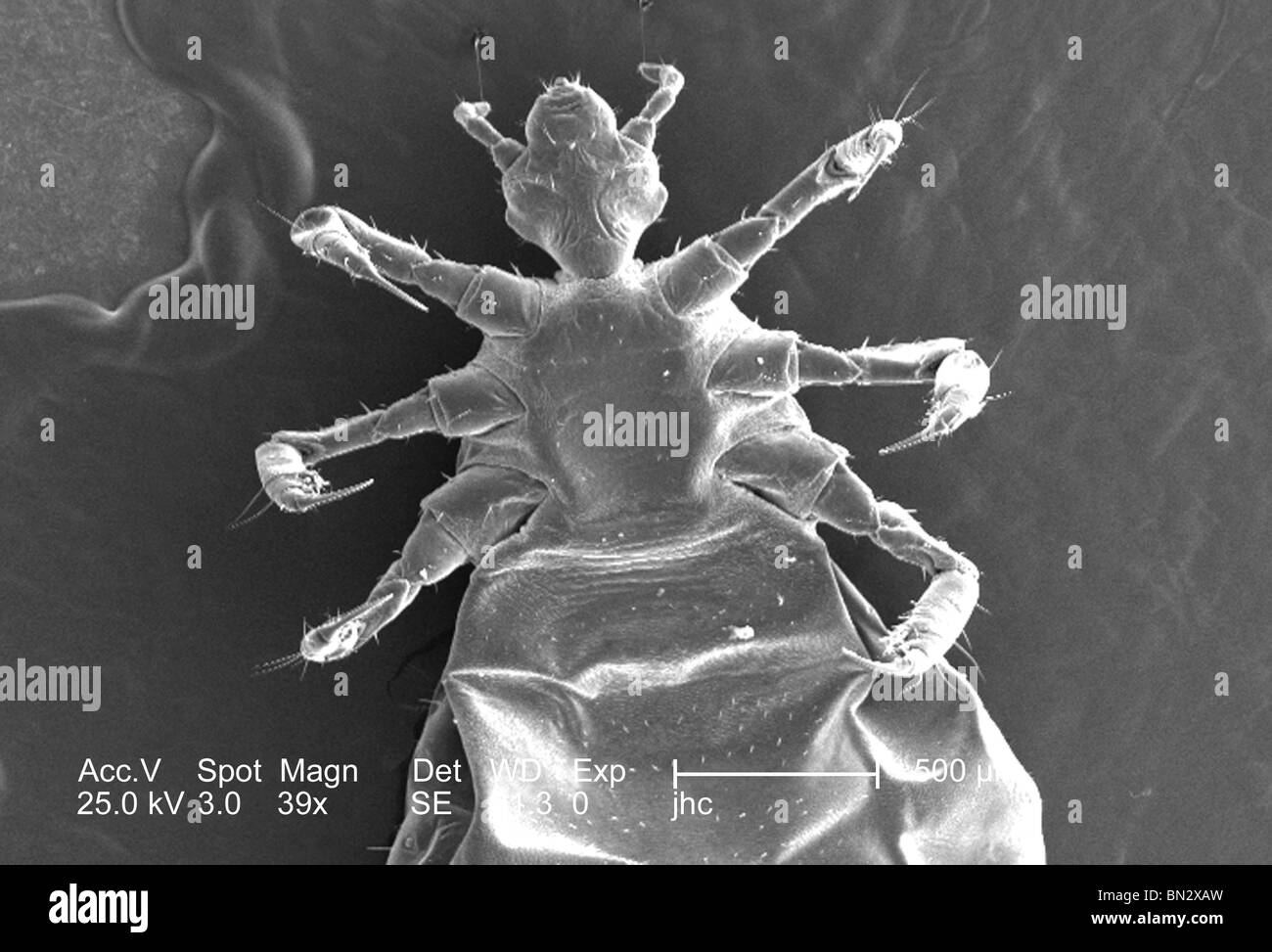 Pediculus humanus corporis hi-res stock photography and images - Alamy
