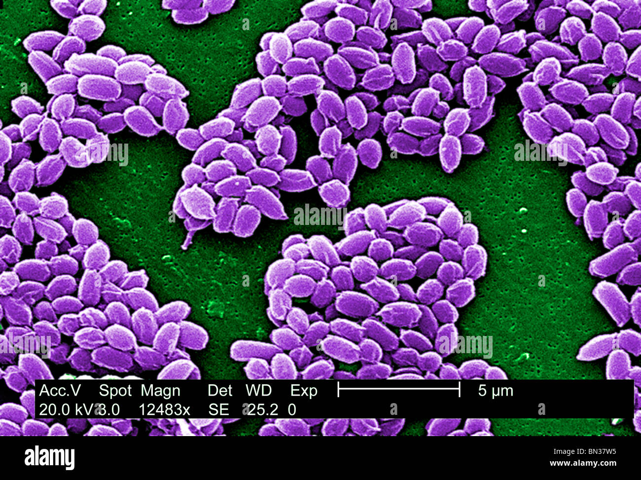 SEM of Anthrax bacteria spores (Bacillus anthracis Stock Photo Alamy