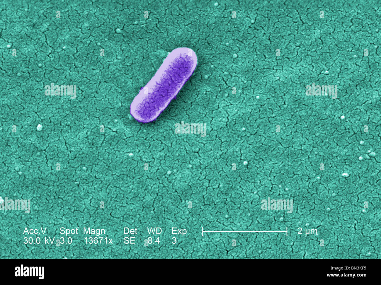Colorized scanning electron micrograph of Escherichia coli O157H7 at a magnification of 13671x