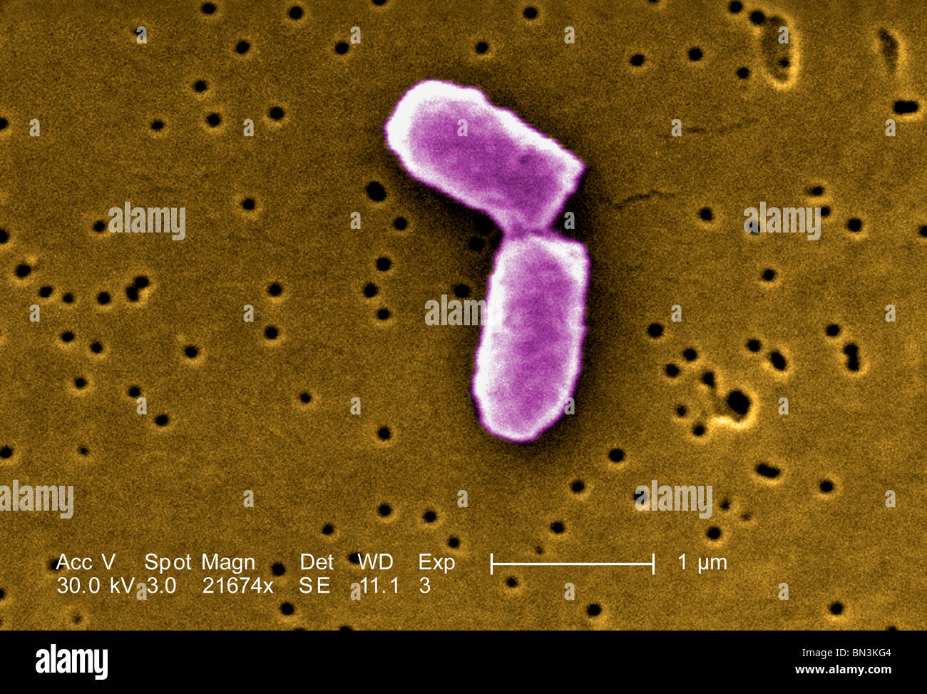 Colorized scanning electron micrograph (SEM) showing a dividing Escherichia coli bacterium Stock Photo
