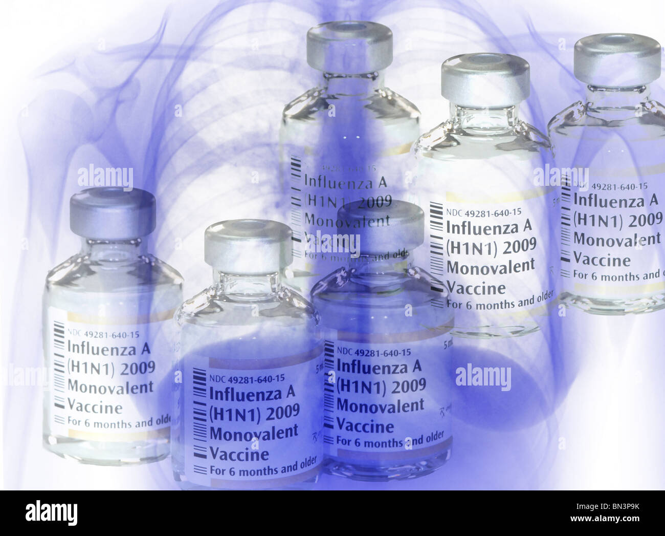 vials of the 2009 H1N1 swine flu vaccine superimposed on a chest x-ray of a patient with swine flu pneumonia Stock Photo