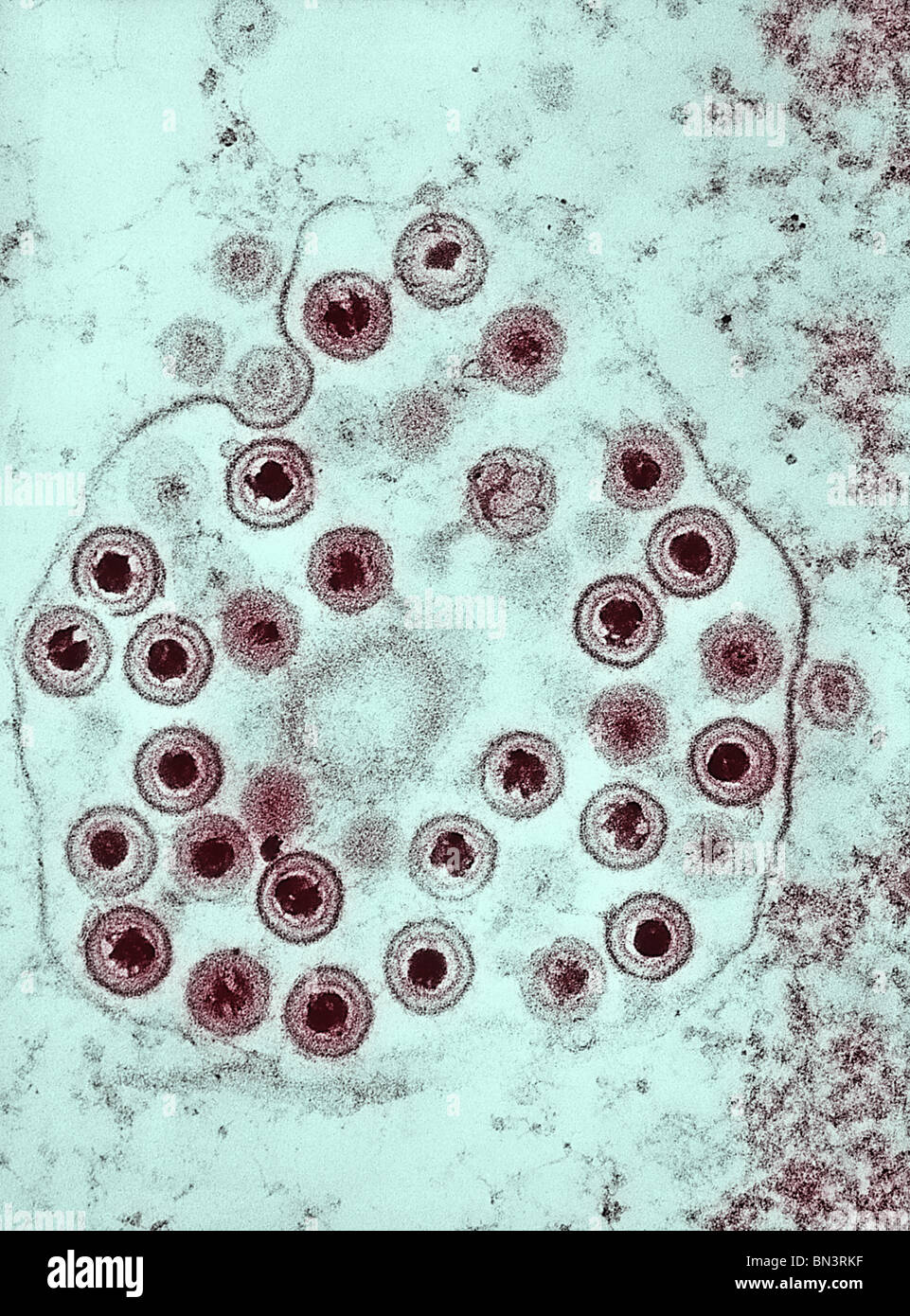 Negatively-stained transmission electron micrograph (TEM) of numerous herpes simplex virions Stock Photo