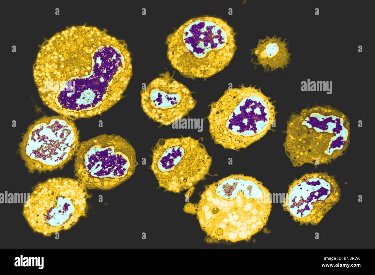 Colorized transmission electron microscope image of human white blood