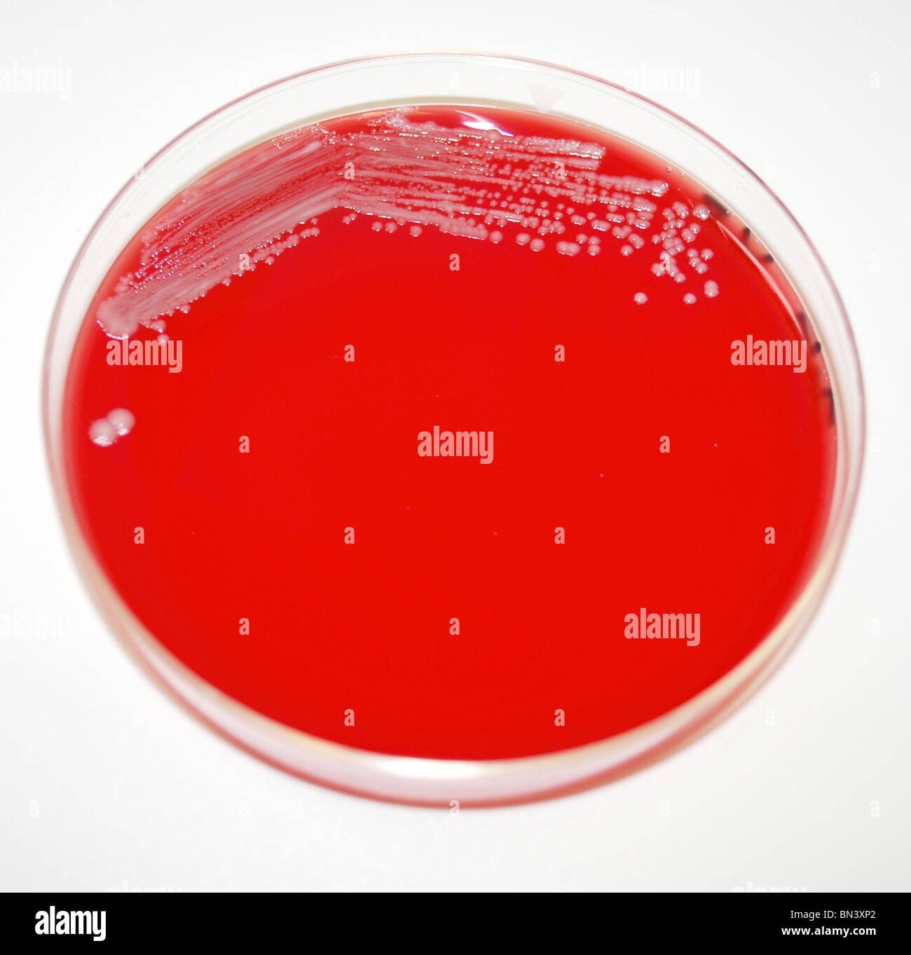 Agar Plate Showing Plague Bacteria Yersinia Pestis Stock Photo Alamy Agar Plate Showing Plague Bacteria Yersinia Pestis Stock Photo Alamy