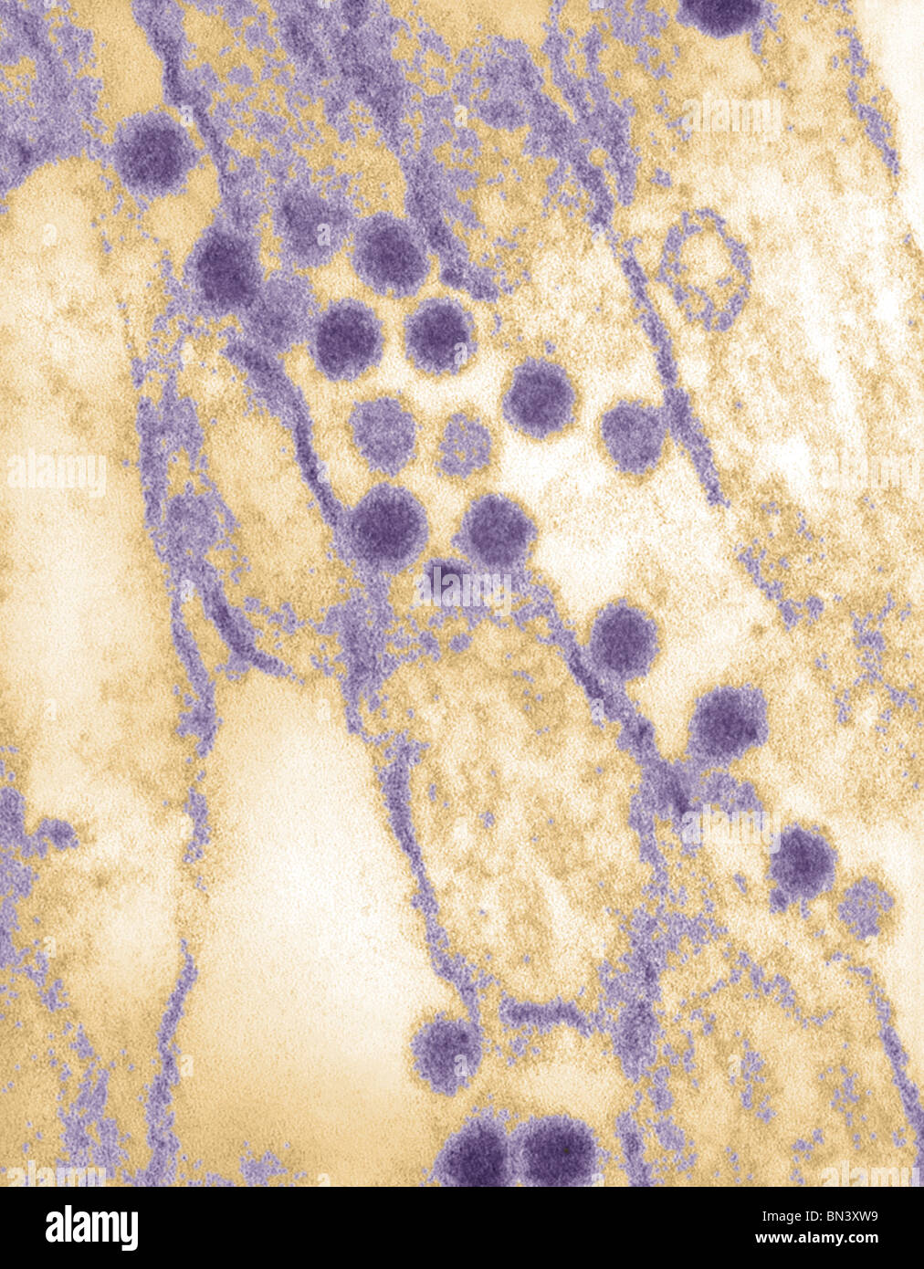 Negatively-stained transmission electron micrograph (TEM) of St. Louis encephalitis virions within a tissue sample Stock Photo