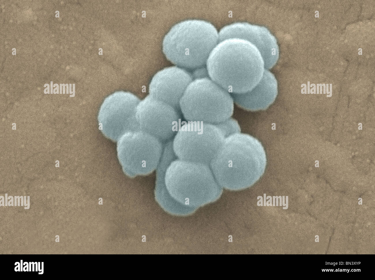 Scanning electron micrograph (SEM) of a clustered group of Gram-positive, beta-hemolytic Group C Streptococcus bacteria Stock Photo