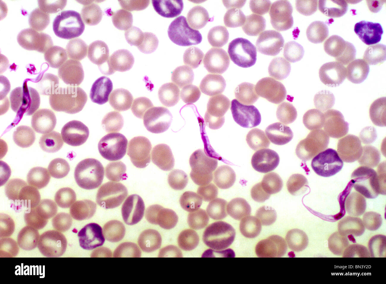 Light photomicrograph of a rat blood smear showing Trypanosoma lewisi parasites, using a Giemsa stain technique Stock Photo