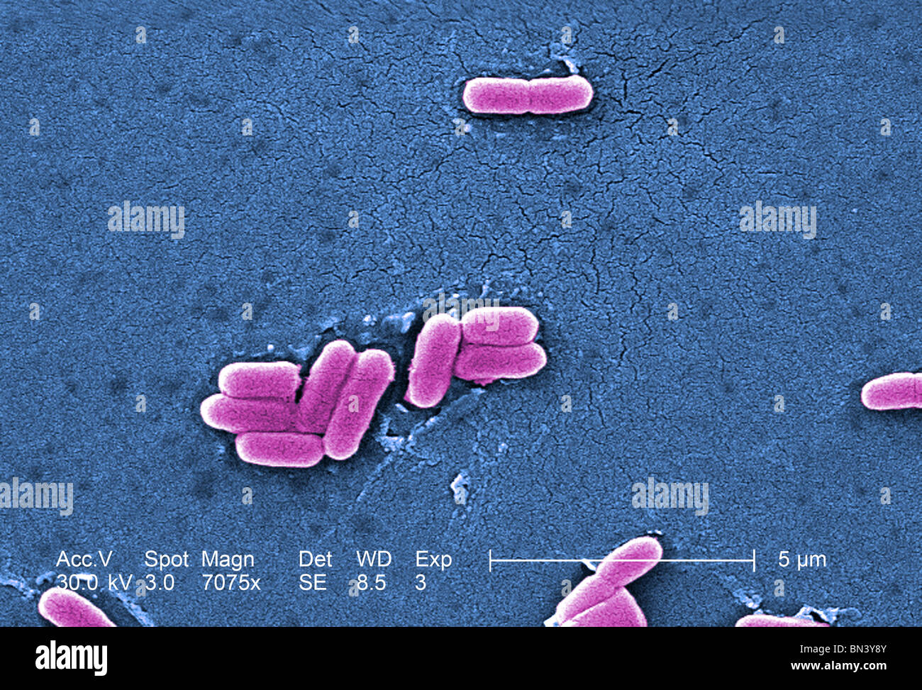 Colorized scanning electron micrograph of Escherichia coli O157H7 at a magnification of 7075x