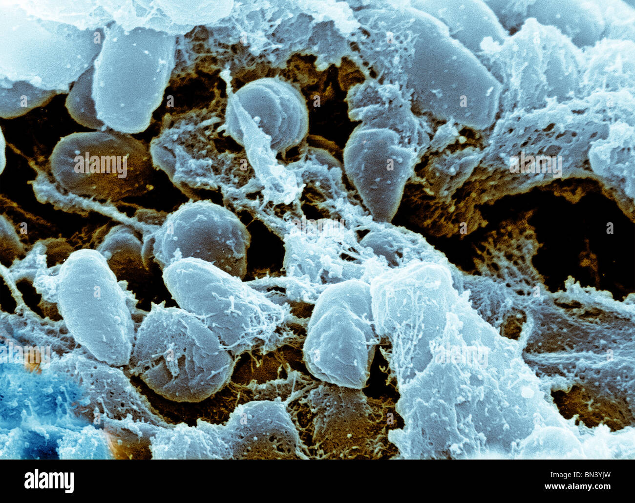 Colorized scanning electron microscope (SEM) image of Yersinia pestis ...