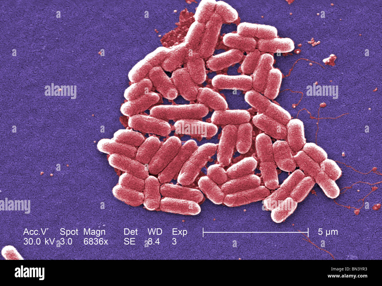 Colorized scanning electron micrograph of Escherichia coli O157:H7 at a magnification of 6836x Stock Photo