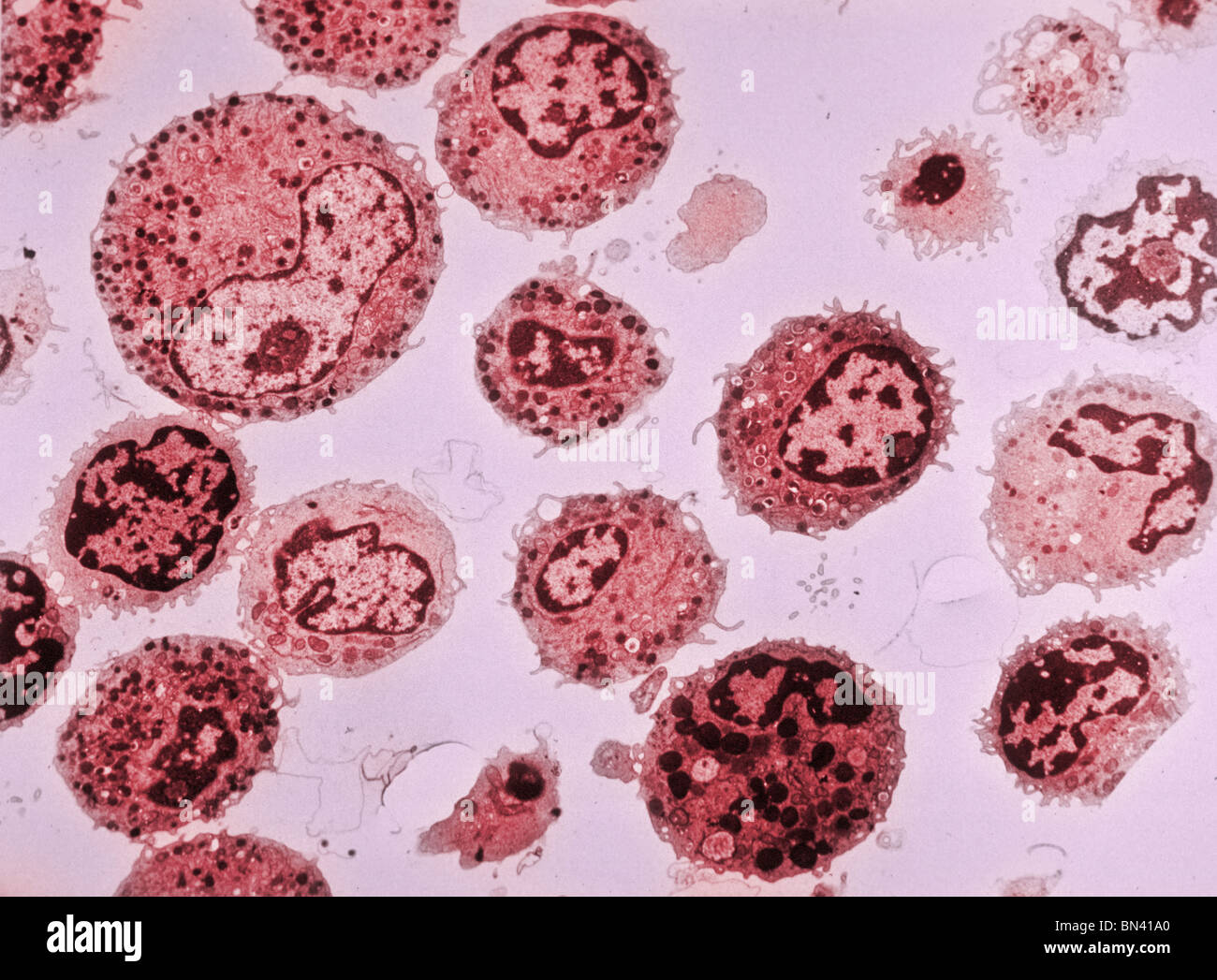 Colorized Transmission Electron Microscope Image Of Human White Blood Colorized Transmission Electron Microscope Image Of Human White Blood