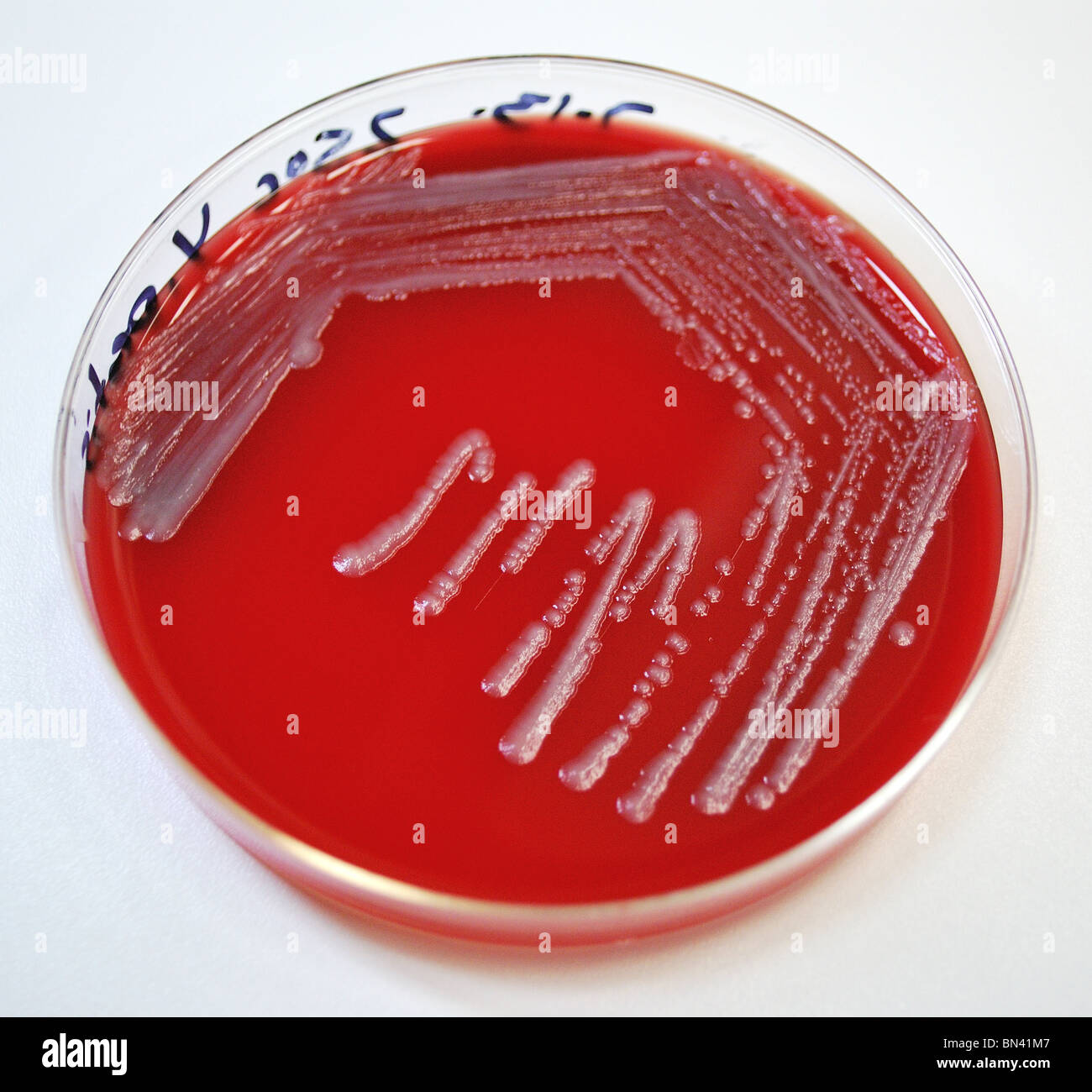 Agar Plate Growing Yersinia Pestis Bacteria The Cause Of Plague Stock Agar Plate Growing Yersinia Pestis Bacteria The Cause Of Plague Stock