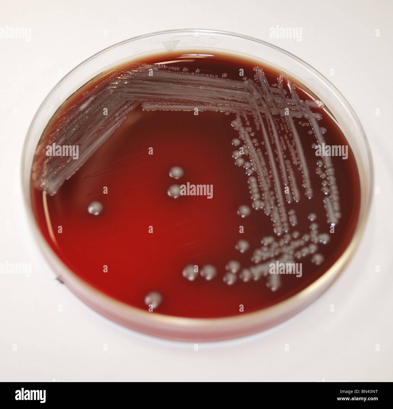 Petri dish containing a sheep's blood agar medium, which had been inoculated with Gram-negative Yersinia pestis bacteria Stock Photo