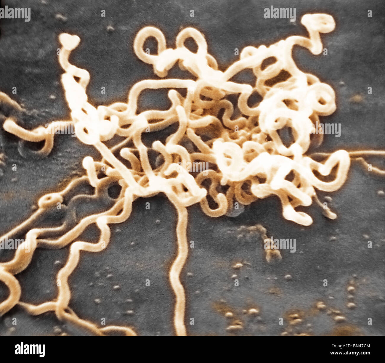 Electron micrograph of Treponema pallidum, the bacterium which causes syphilis Stock Photo