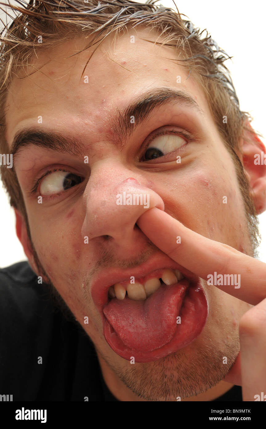 Crazy wacky ugly man with crooked teeth and acne and veins above his eyes. To top it off, he is picking his nose. Stock Photo