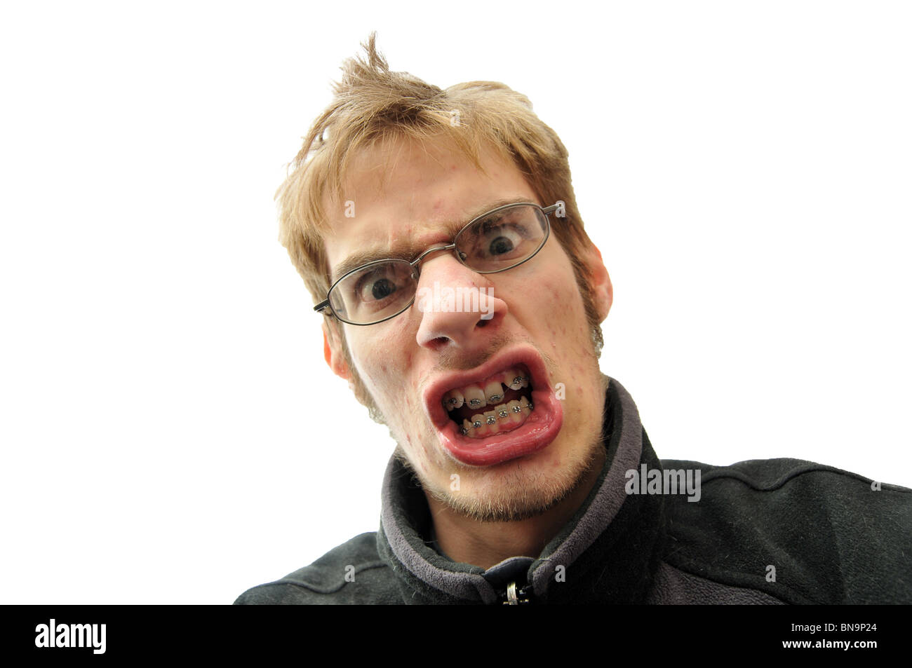 Mean man with braces isolated on white Stock Photo