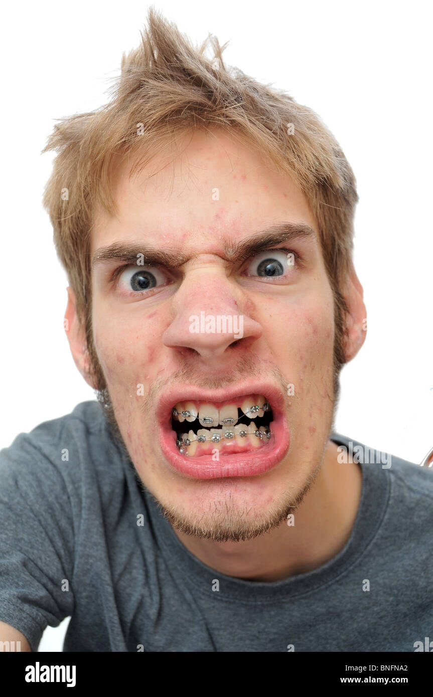 Man showing his braces isolated on white Stock Photo