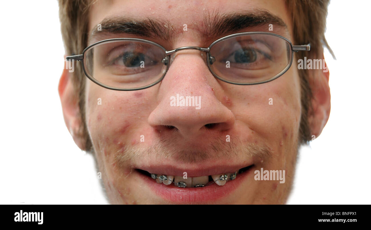 Geek braces hires stock photography and images Alamy