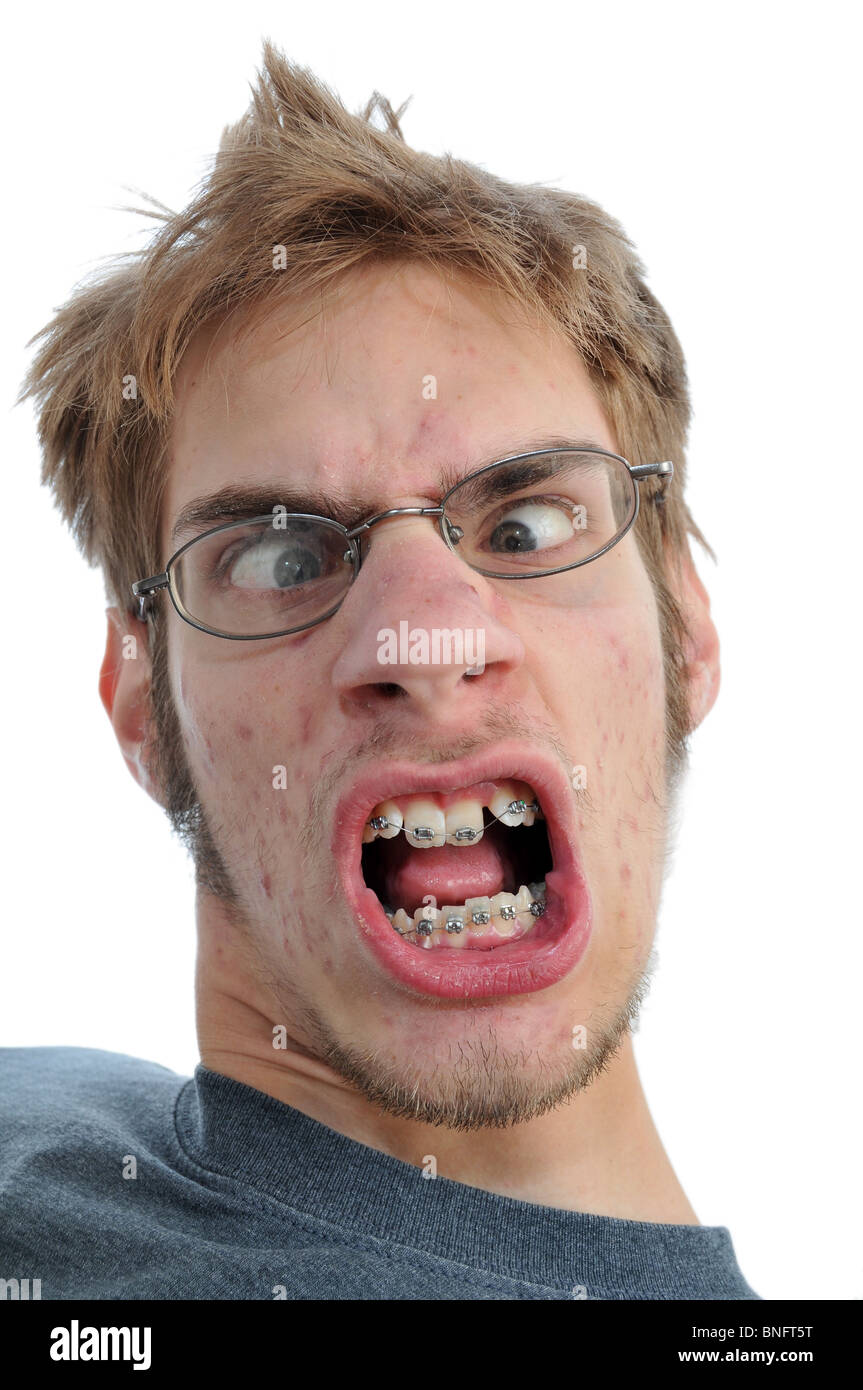 Man showing his braces face close up Stock Photo