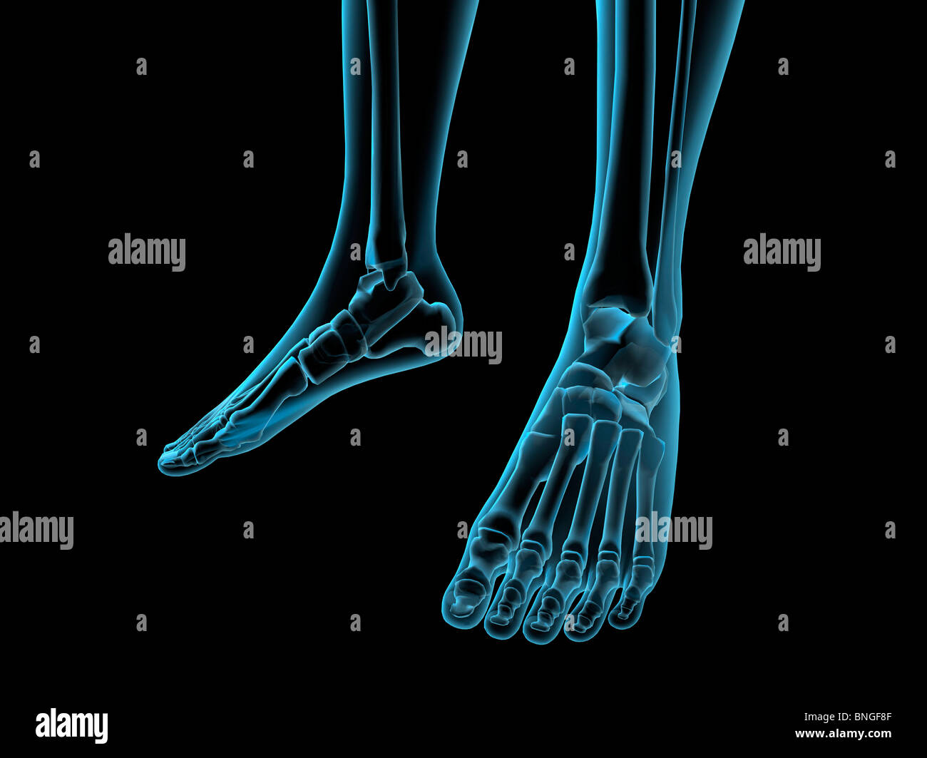 Xray view of foot bones Stock Photo Alamy