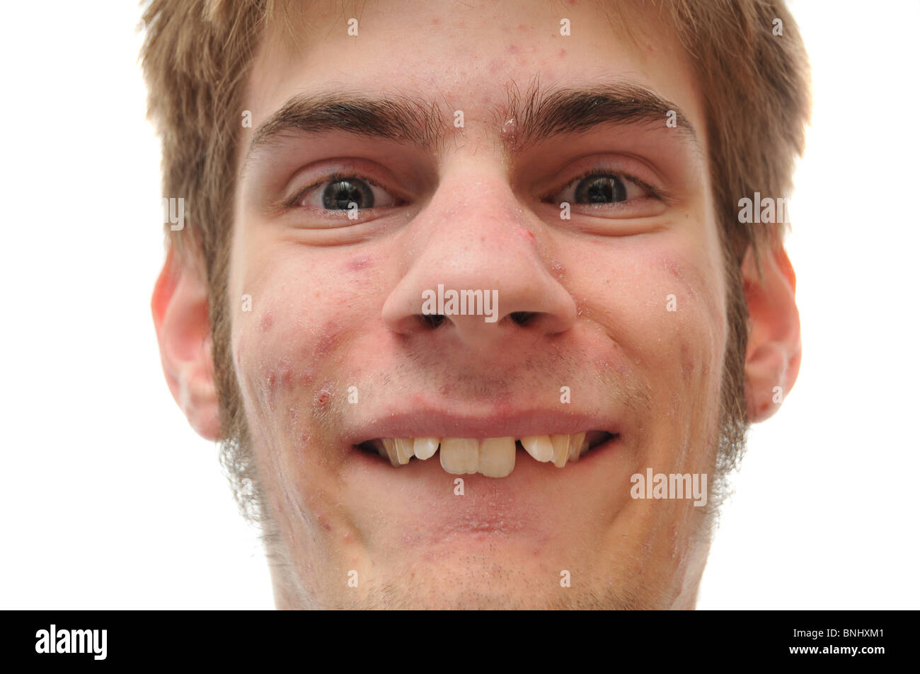 Weird white Caucasian facial expression smiling isolated on white background. Crooked teeth, he needs braces Stock Photo
