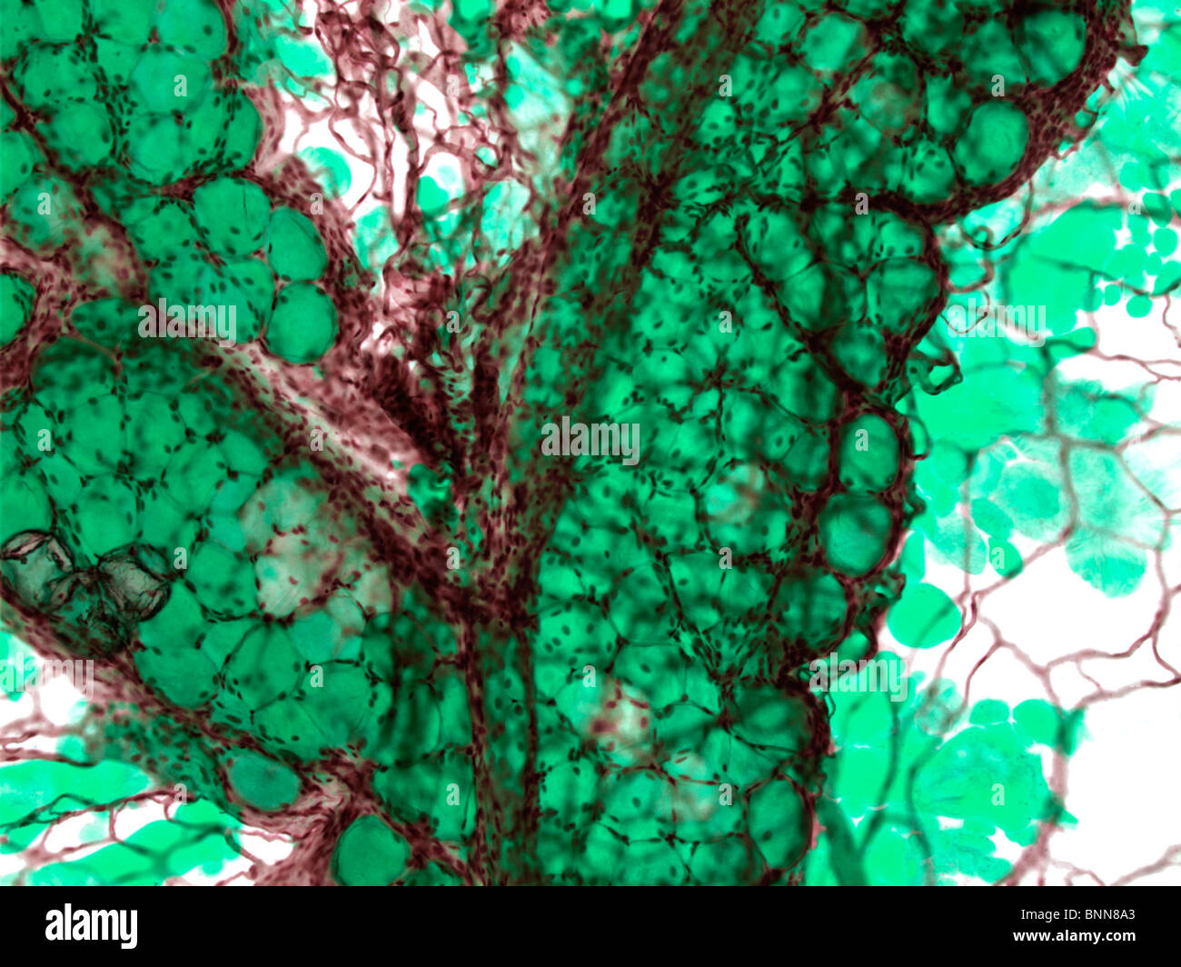 Fat tissue, light micrograph Stock Photo - Alamy