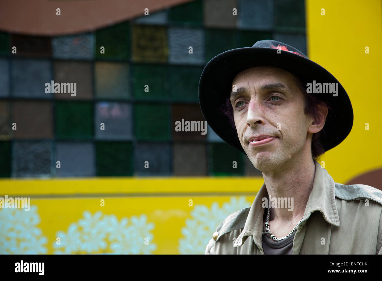 EhlersDanlos Syndrome disorder of connective tissue. A Sufferer