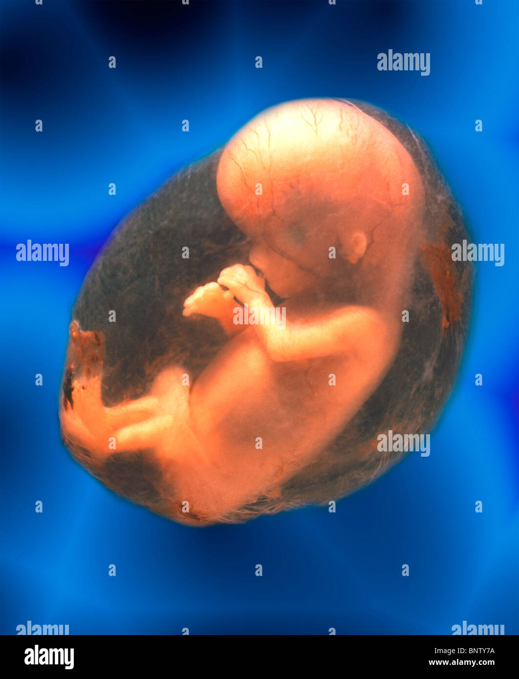 Unborn Human Fetus Stock Photo