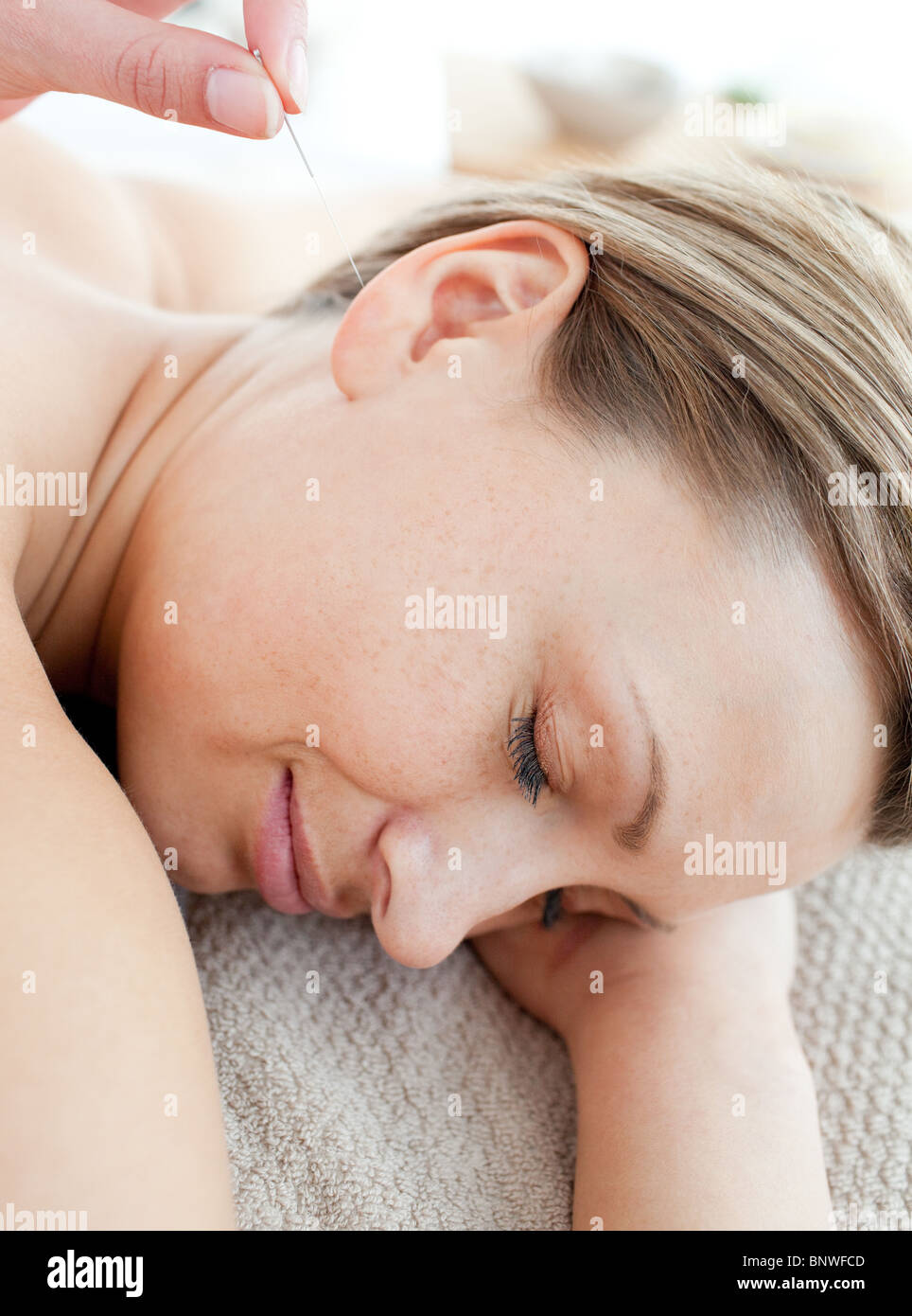 Close-up of a young woman in acupuncture therapy Stock Photo